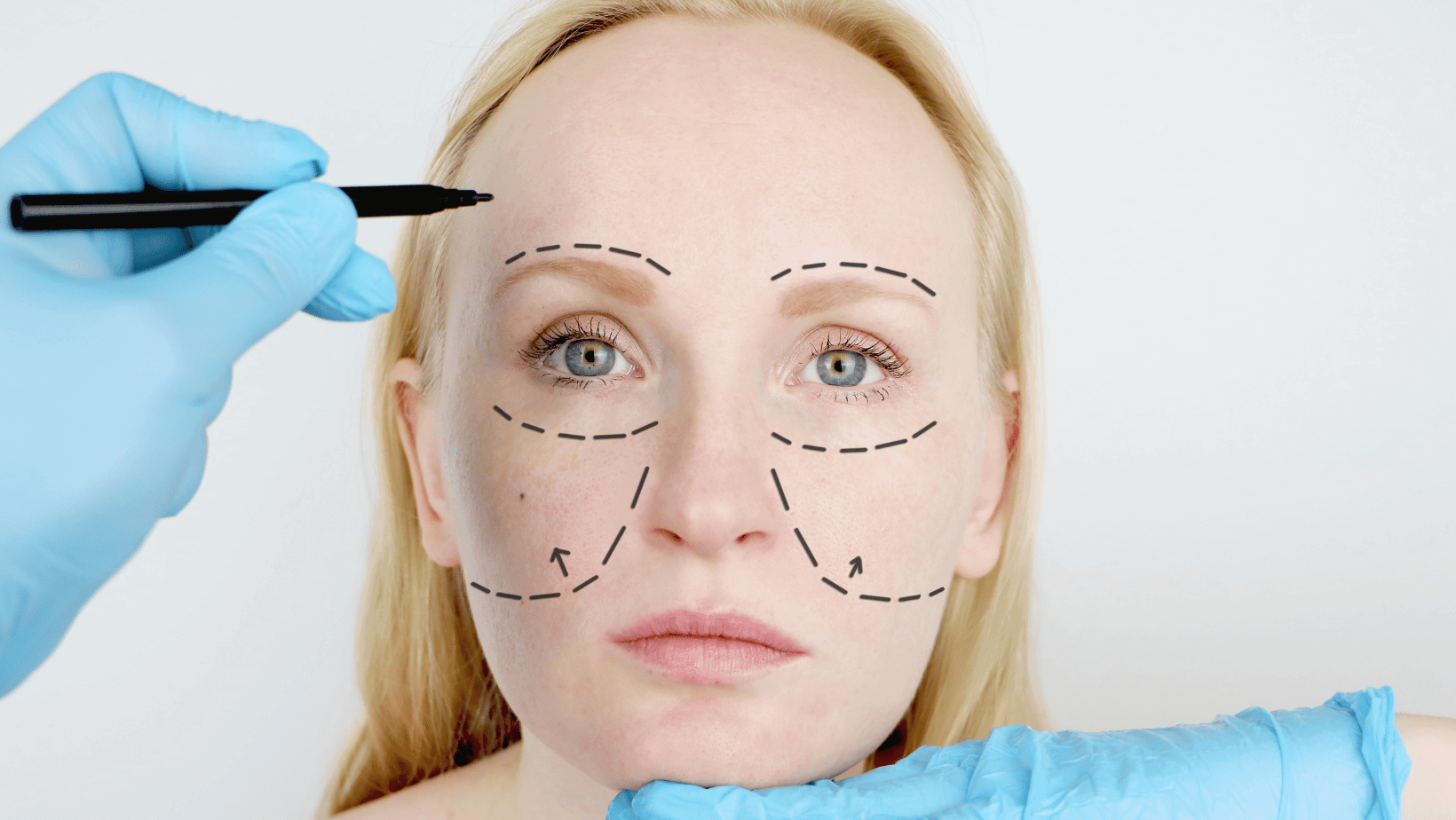 a-guide-to-finding-your-perfect-facelift-unveiling-todays-modern-techniques-barbies-beauty-bits a-guide-to-finding-your-perfect-facelift-unveiling-todays-modern-techniques-barbies-beauty-bits