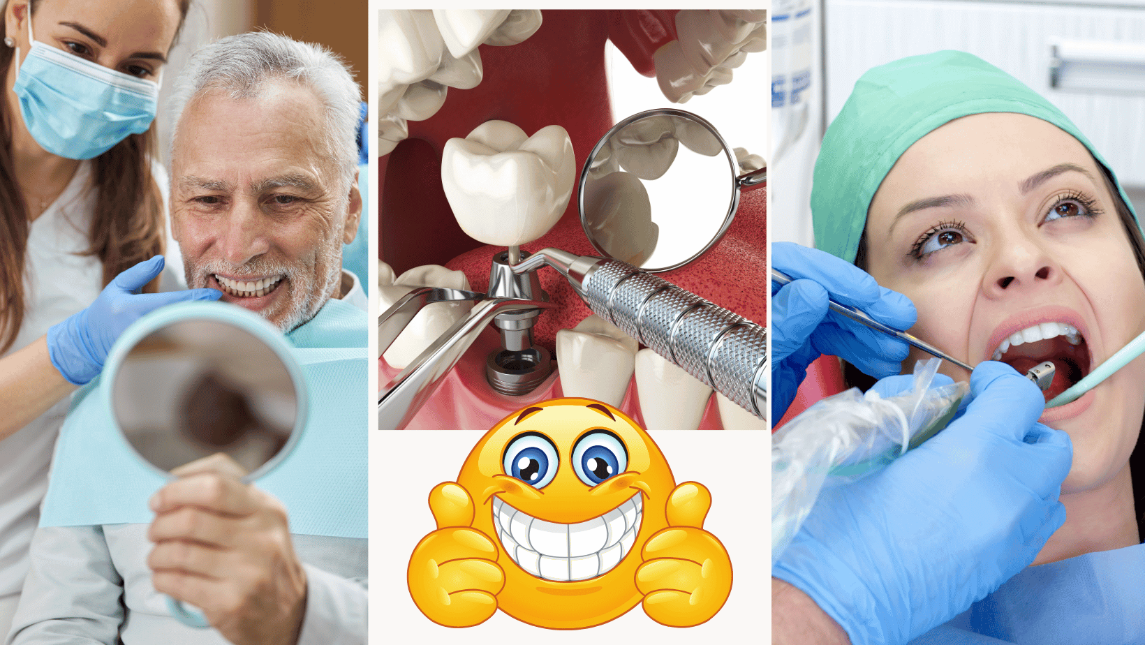 all-on-4-implants-before-during-and-after-care-barbies-beauty-bits