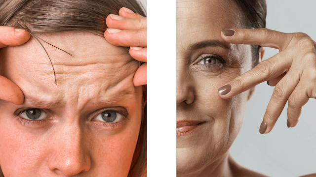 best-cosmetic-treatments-for-wrinkles-look-barbies-beauty-bits best-cosmetic-treatments-for-wrinkles-look-barbies-beauty-bits