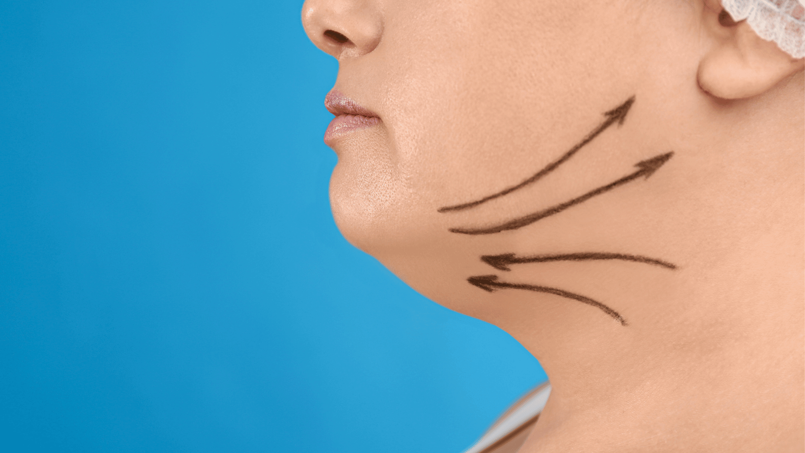 mini-facelift-procedure-barbies-beauty-bits mini-facelift-procedure-barbies-beauty-bits